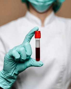 ������ ����� �� �������� � COVID-19