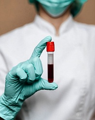 ������ ����� �� �������� � COVID-19